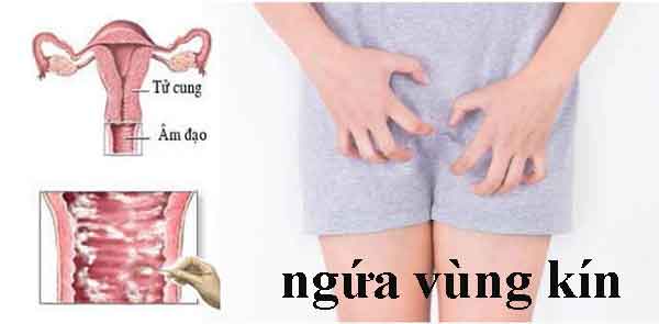 Tác dụng phụ của gel bôi trơn là ngứa âm đạo khi sử dụng gel rẻ kém chất lương