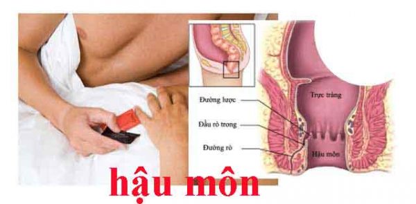 gel bôi trơn hậu môn